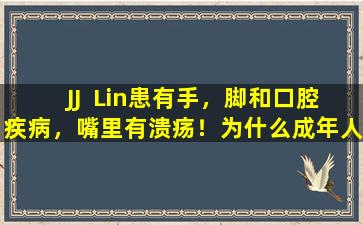 JJ  Lin患有手，脚和口腔疾病，嘴里有溃疡！为什么成年人也患有手，脚和口腔疾病？如何防止它？